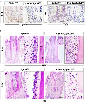 Transforming Growth Factor-β Signaling Regulates Tooth Root Dentinogenesis by Cooperation With Wnt Signaling